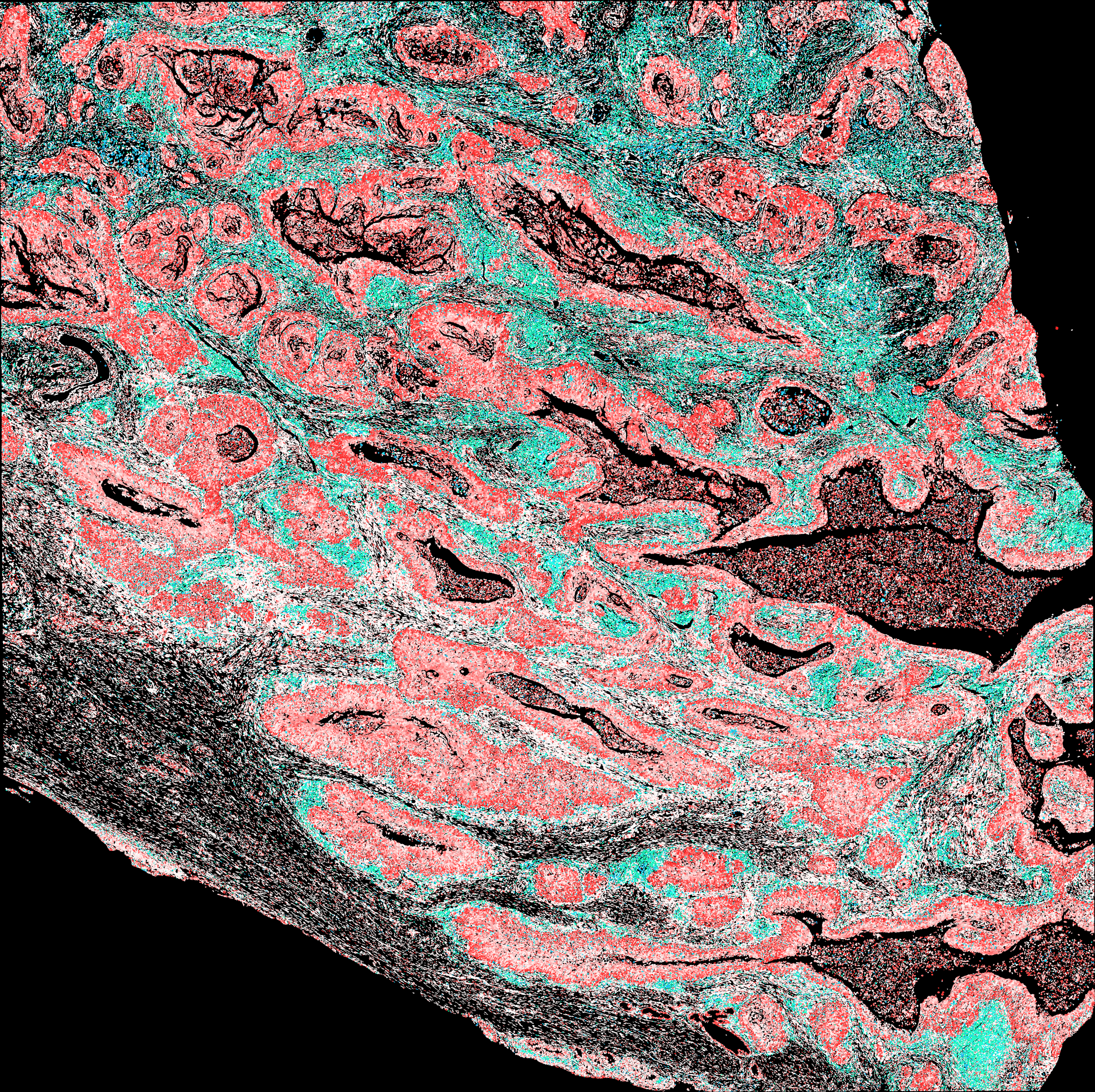 Whole-section combined cell-type and malignancy mask